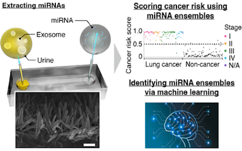 Perfilado de microARNs en exosomas urinarios para la detección temprana de cáncer
