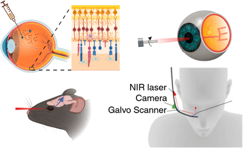 Bipolar Cells of the Eye Treated with Plasmonic Gold Nanorods and Activated with Infrared Laser to Restore Vision